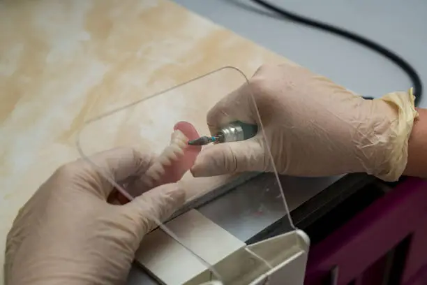 Implantologia — Studio Dentistico Gaudenzi
