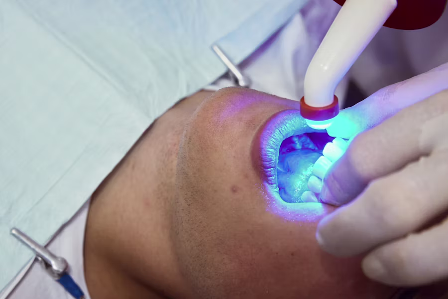 Sbiancamento denti professionale in studio — Studio Dentistico Gaudenzi