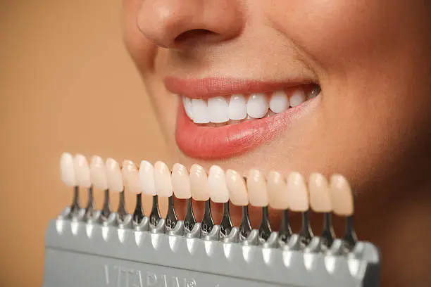 Sorriso perfetto con trattamenti di estetica dentale — Studio Dentistico Gaudenzi